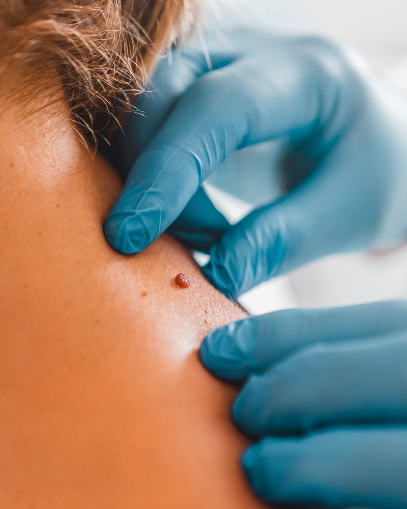 dermatologo bergamo